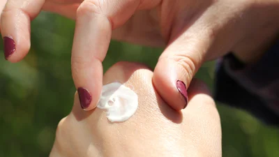 treat eczema with zinc oxide