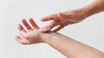 CCL_Zinc-Oxide-Defends-Against-Allergies_thumbnail