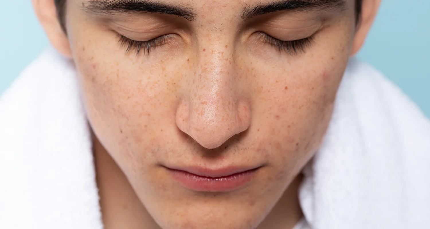 CCL_Zinc-Oxide-for-Dark-Spots-A-Natural-Solution-for-Even-Toned-Skin_thumbnail