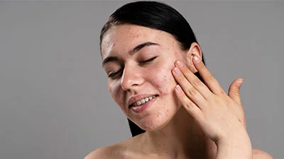 CCL_Why-Non-Nano-Zinc-Oxide-is-a-Game-Changer-for-Sensitive-Skin_thumbnail